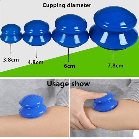 4-Piece Silicone Cupping Therapy Set For Body Massage - Blue